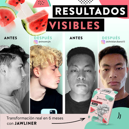 Chicle para Mandíbula - Sandía - Medium